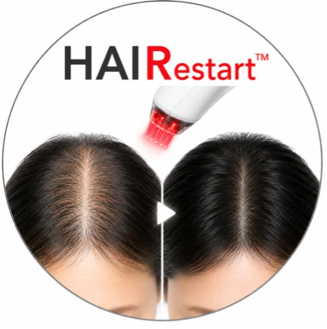 ヘアリスタート